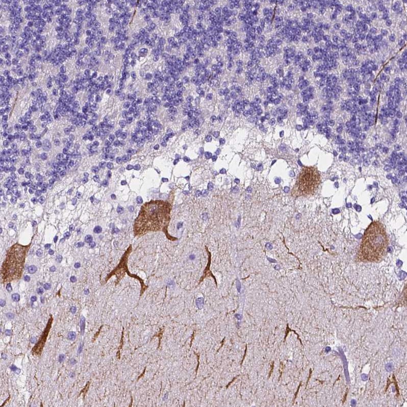 Calsyntenin-2 Antibody - BSA Free Immunohistochemistry-Paraffin: Calsyntenin-2 Antibody - BSA Free [NBP1-85705]