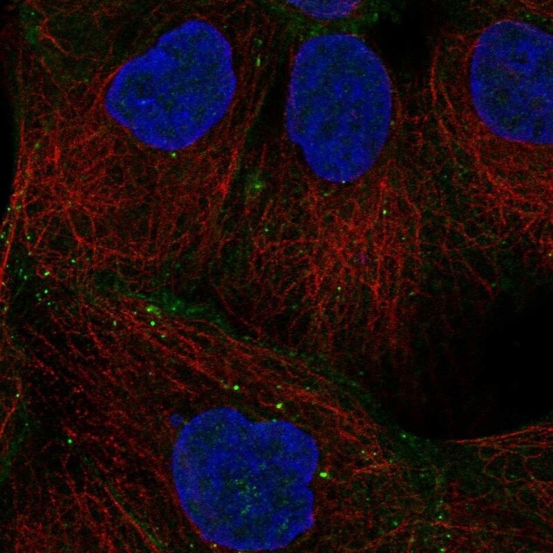 Desmoglein-2 Antibody - BSA Free Immunocytochemistry/ Immunofluorescence: Desmoglein-2 Antibody [NBP1-85709]