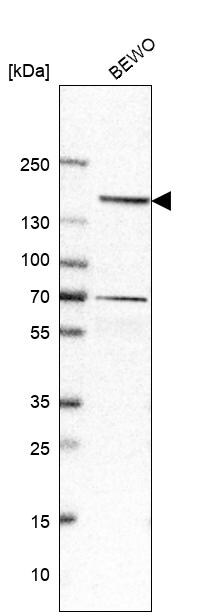 Desmoglein-2 Antibody - BSA Free Western Blot: Desmoglein-2 Antibody - BSA Free [NBP1-85709]