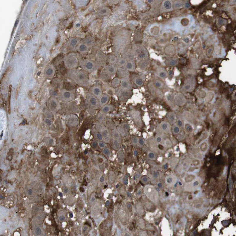 Cadherin-20 Antibody - BSA Free Immunohistochemistry-Paraffin: Cadherin-20 Antibody - BSA Free [NBP1-85713]