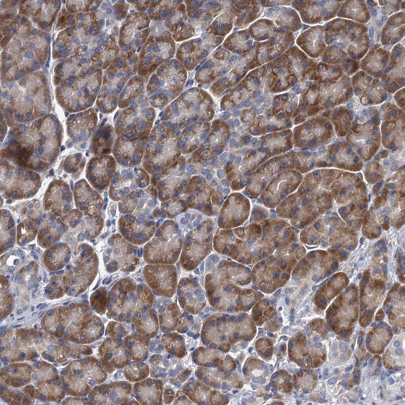 ALG2 Antibody - BSA Free Immunohistochemistry-Paraffin: ALG2 Antibody [NBP1-85715]
