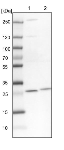 PMM2/Phosphomannomutase 2 Antibody - BSA Free Western Blot: PMM2/Phosphomannomutase 2 Antibody - BSA Free [NBP1-85716]