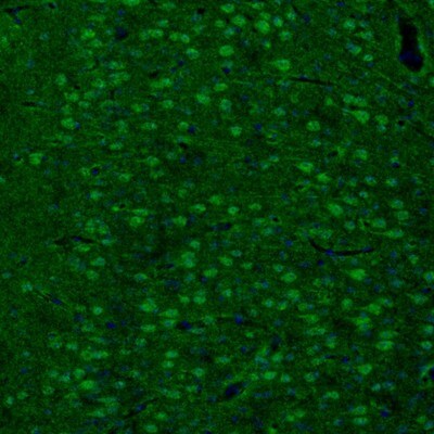 ARHGAP1 Antibody