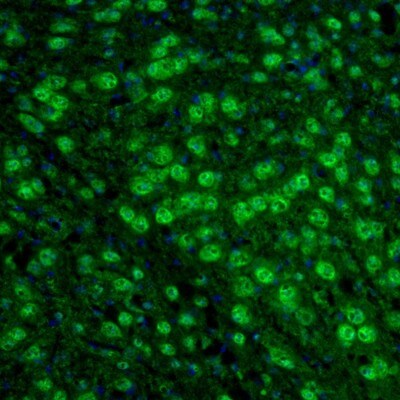 ARHGAP1 Antibody