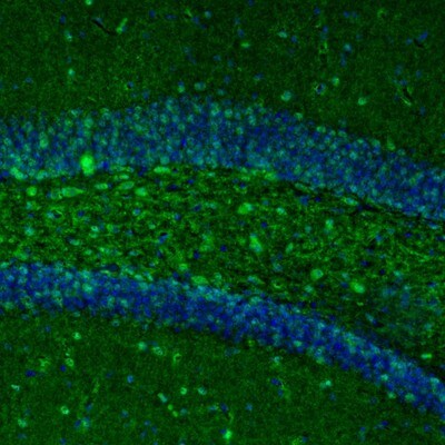 ARHGAP1 Antibody