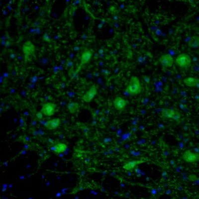 ARHGAP1 Antibody