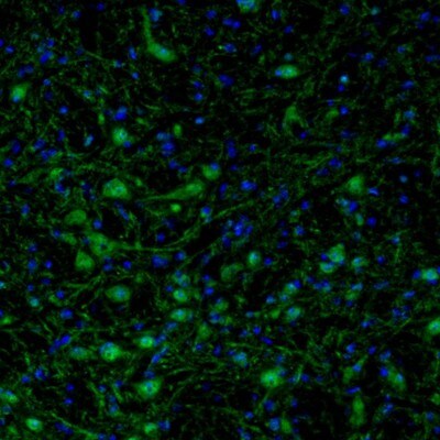 ARHGAP1 Antibody