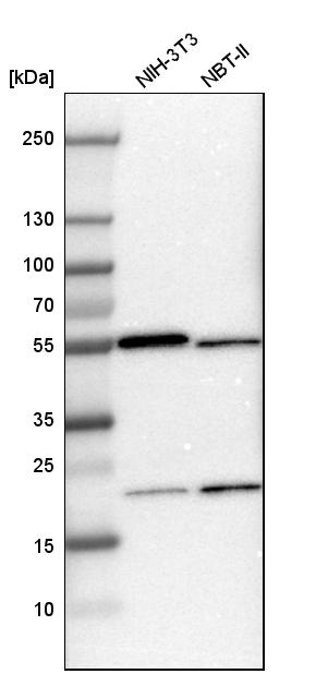 ARHGAP1 Antibody - BSA Free Western Blot: ARHGAP1 Antibody - BSA Free [NBP1-85724]
