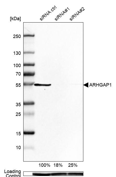 ARHGAP1 Antibody - BSA Free Western Blot: ARHGAP1 Antibody - BSA Free [NBP1-85724]