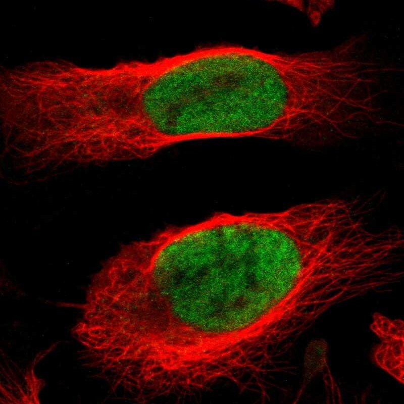 MCM4 Antibody - BSA Free Immunocytochemistry/ Immunofluorescence: MCM4 Antibody - BSA Free [NBP1-85728]