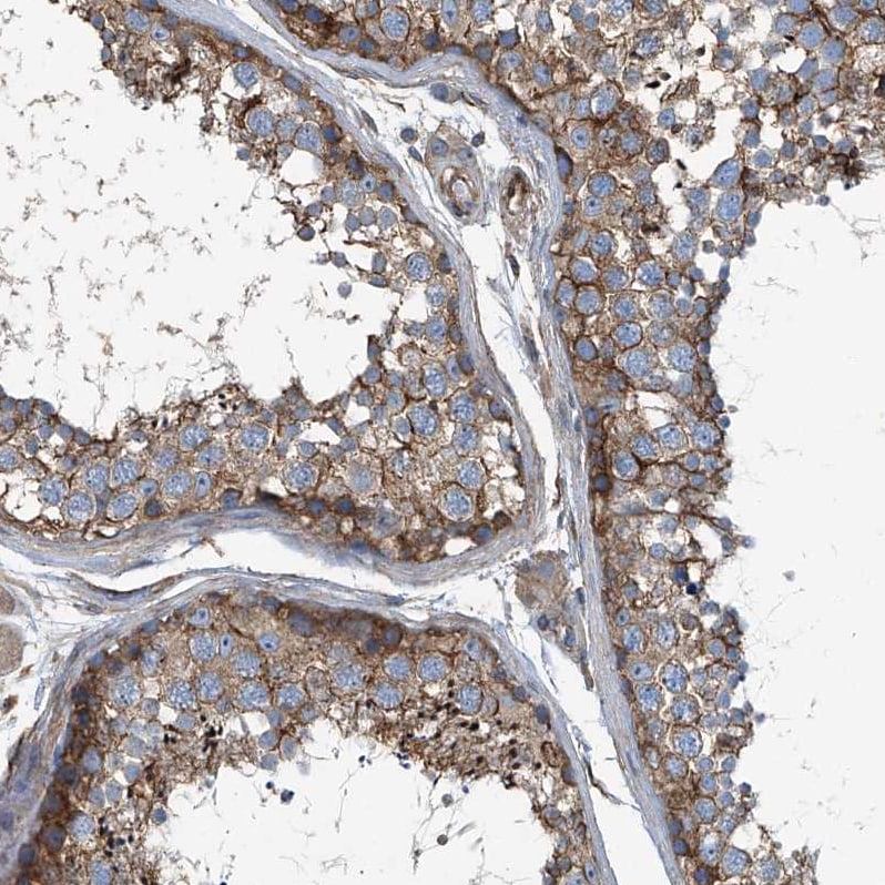 Septin-7 Antibody - BSA Free Immunohistochemistry-Paraffin: Septin-7 Antibody [NBP1-85731]