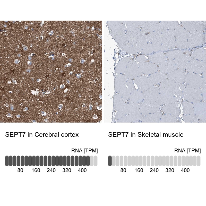 Septin-7 Antibody - BSA Free Immunohistochemistry-Paraffin: Septin-7 Antibody [NBP1-85731]