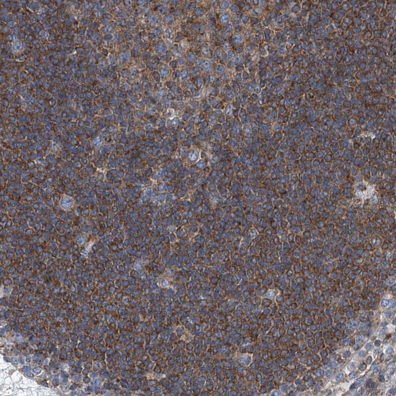 Septin-7 Antibody - BSA Free Immunohistochemistry-Paraffin: Septin-7 Antibody [NBP1-85731]