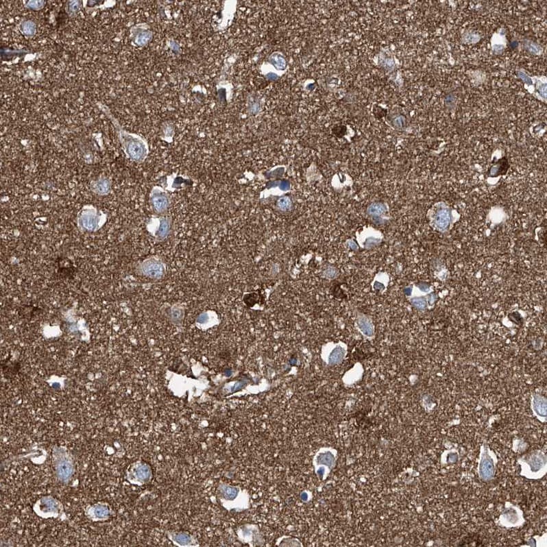 Septin-7 Antibody - BSA Free Immunohistochemistry-Paraffin: Septin-7 Antibody [NBP1-85731]