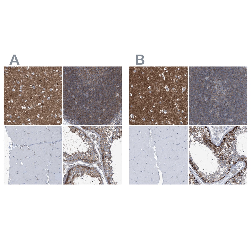 Septin-7 Antibody - BSA Free Immunohistochemistry-Paraffin: Septin-7 Antibody [NBP1-85731]