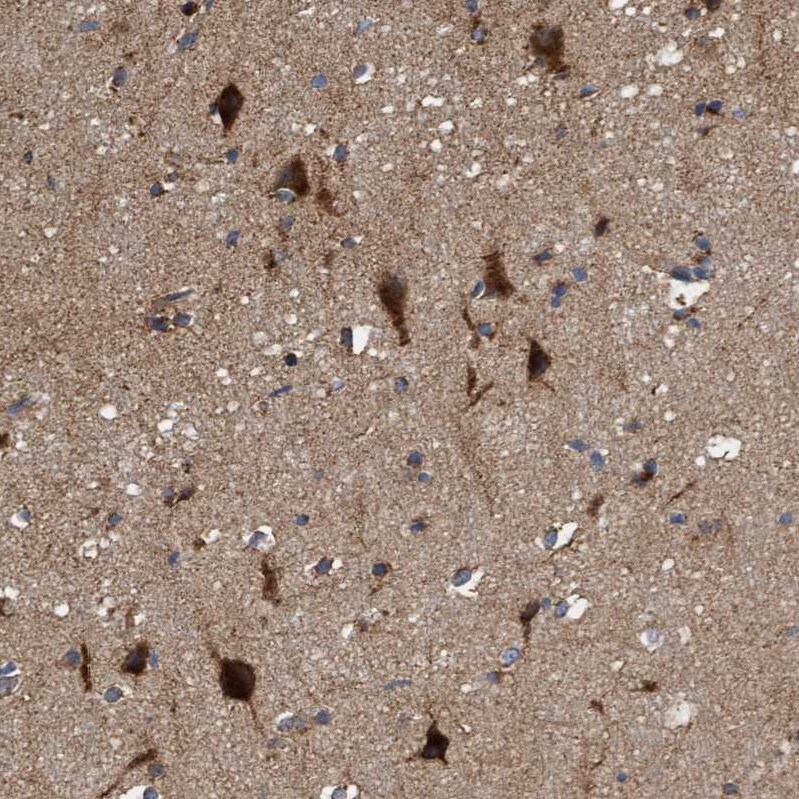 ITFG1 Antibody - BSA Free Immunohistochemistry-Paraffin: ITFG1 Antibody - BSA Free [NBP1-85734]