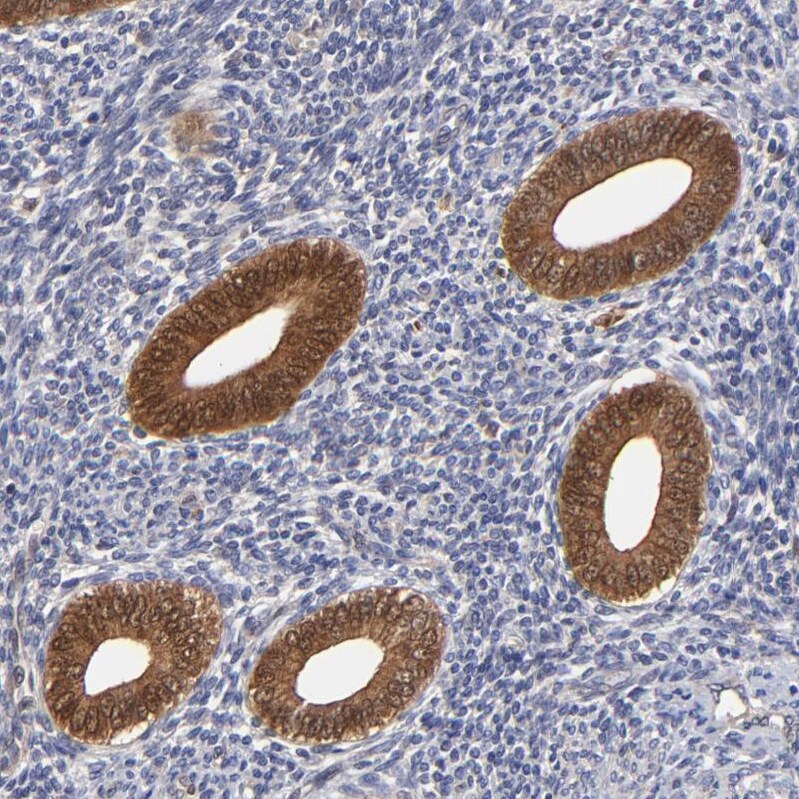 XTP3TPA Antibody - BSA Free Immunohistochemistry-Paraffin: XTP3TPA Antibody - BSA Free [NBP1-85736]