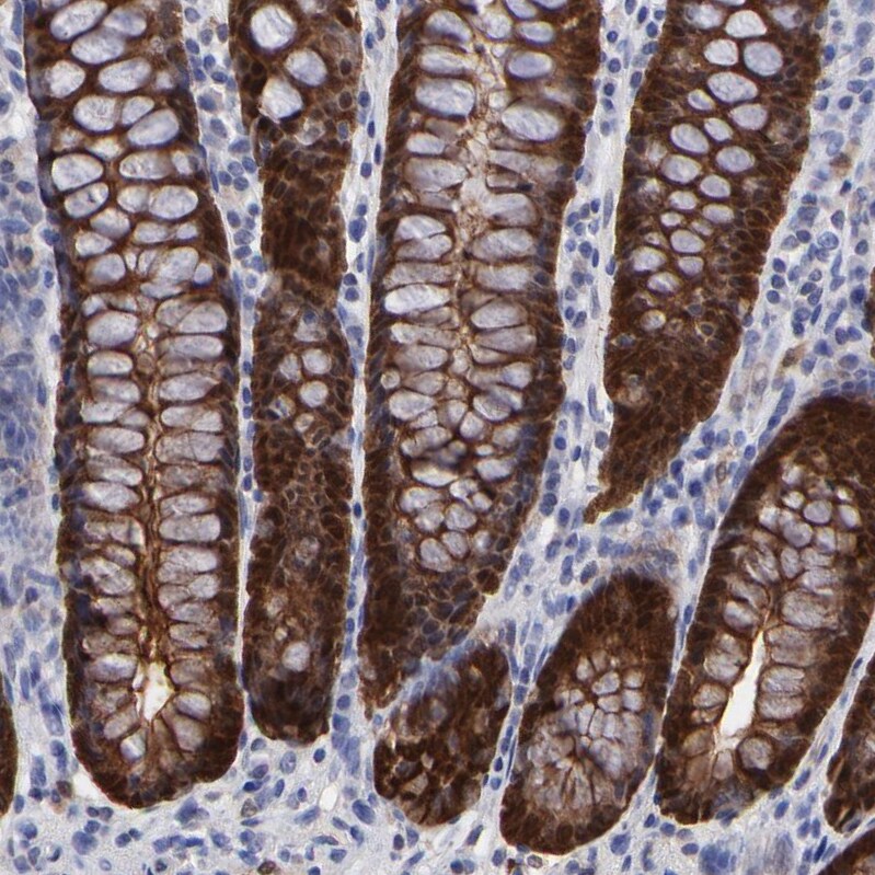 XTP3TPA Antibody - BSA Free Immunohistochemistry-Paraffin: XTP3TPA Antibody - BSA Free [NBP1-85736]