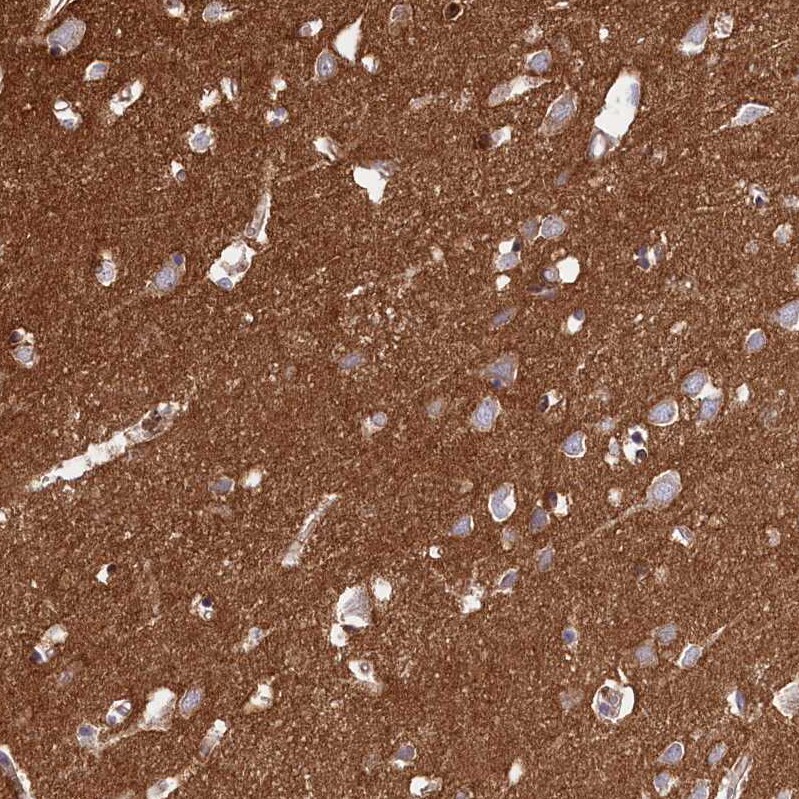 CD99-L2 Antibody - BSA Free Immunohistochemistry-Paraffin: CD99-L2 Antibody - BSA Free [NBP1-85737]
