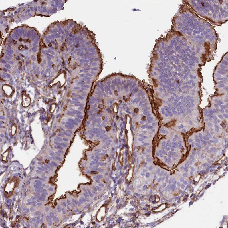 CD99-L2 Antibody - BSA Free Immunohistochemistry-Paraffin: CD99-L2 Antibody - BSA Free [NBP1-85737]