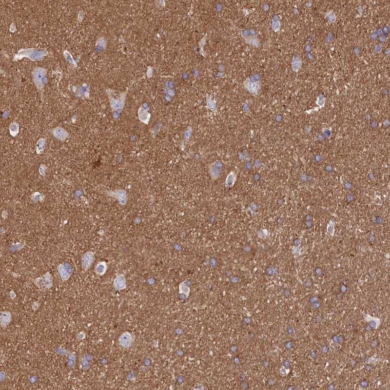 CD99-L2 Antibody - BSA Free Immunohistochemistry: CD99-L2 Antibody - BSA Free [NBP1-85738]