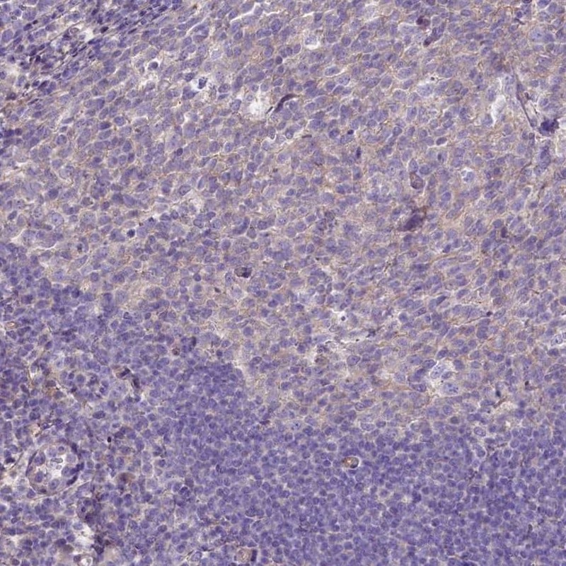 CD99-L2 Antibody - BSA Free Immunohistochemistry: CD99-L2 Antibody - BSA Free [NBP1-85738]