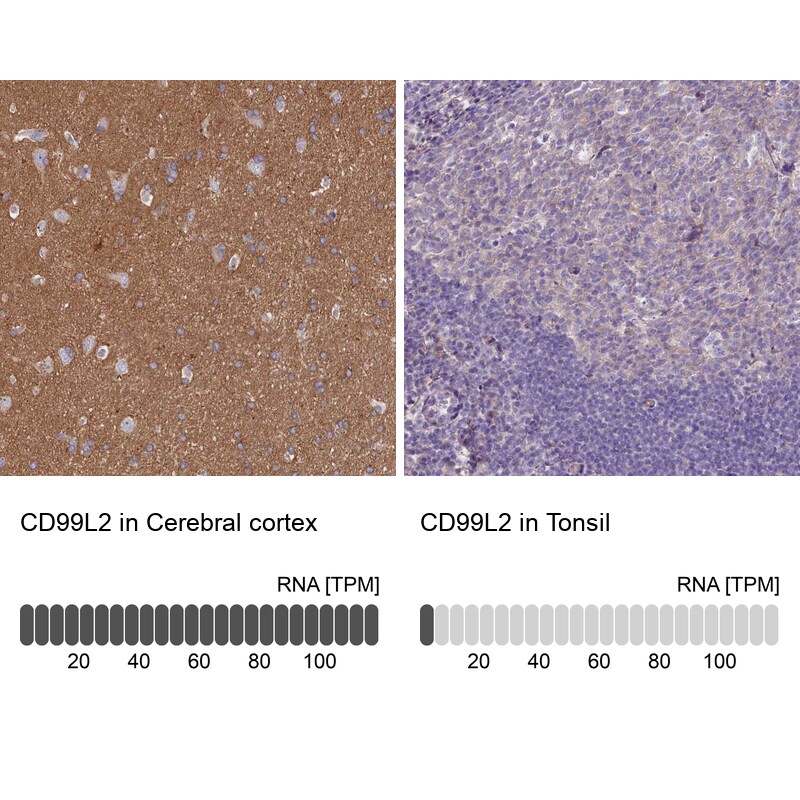 CD99-L2 Antibody - BSA Free Immunohistochemistry: CD99-L2 Antibody - BSA Free [NBP1-85738]