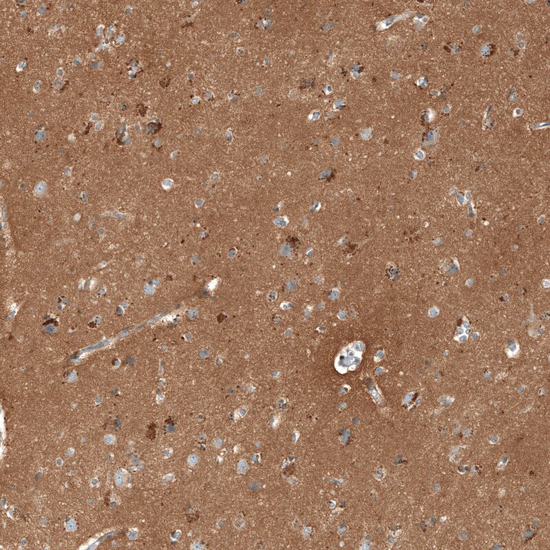 CD90/Thy1 Antibody - BSA Free Immunohistochemistry-Paraffin: CD90/Thy1 Antibody - BSA Free [NBP1-85739]