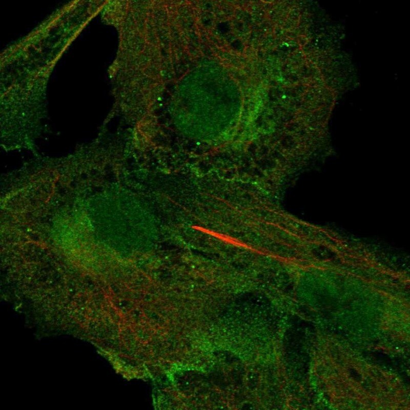 5'-Nucleotidase/CD73 Antibody - BSA Free Immunocytochemistry/ Immunofluorescence: 5'-Nucleotidase/CD73 Antibody [NBP1-85740]