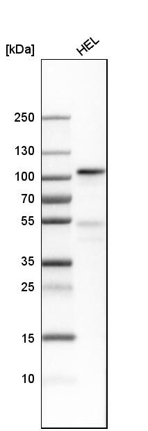 TfR (Transferrin R) Antibody - BSA Free Western Blot: TfR (Transferrin R) Antibody - BSA Free [NBP1-85741]