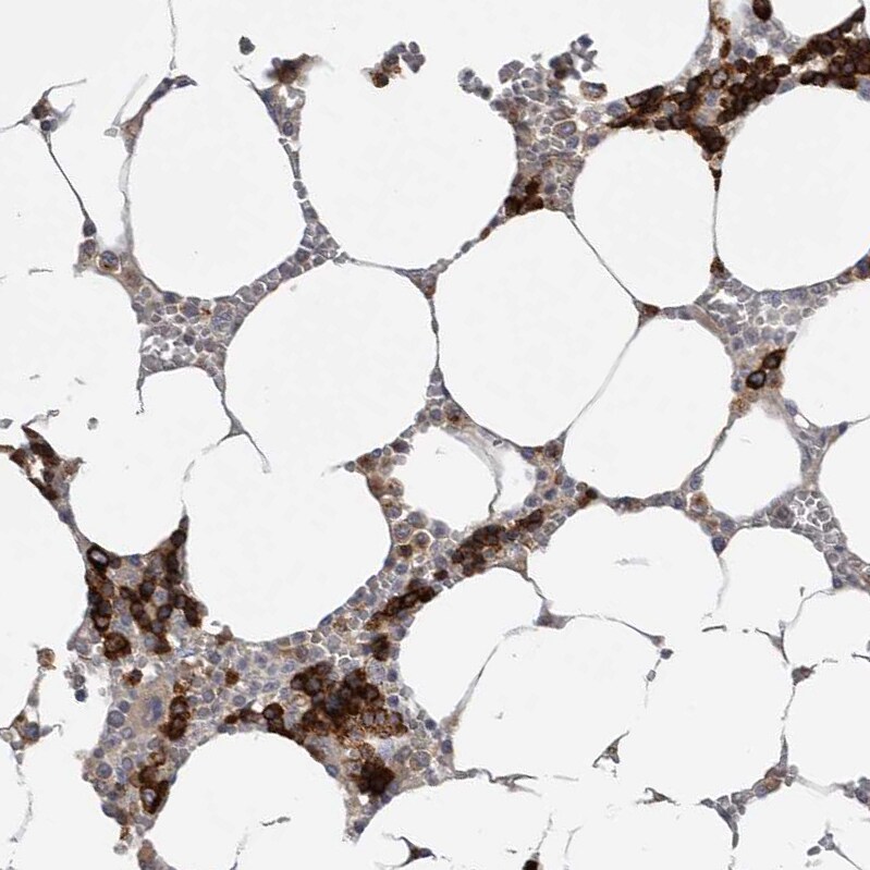 TfR (Transferrin R) Antibody - BSA Free Immunohistochemistry-Paraffin: TfR (Transferrin R) Antibody - BSA Free [NBP1-85741]