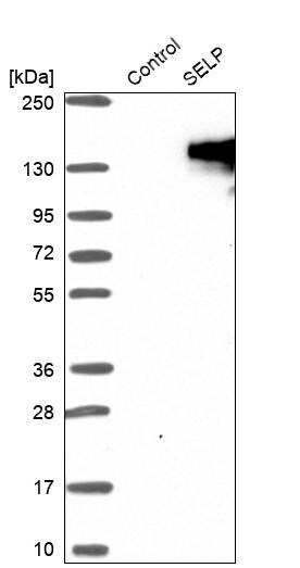 P-Selectin/CD62P Antibody - BSA Free Western Blot: P-Selectin/CD62P Antibody - BSA Free [NBP1-85744]