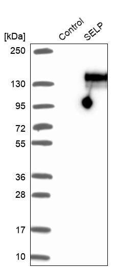 P-Selectin/CD62P Antibody - BSA Free Western Blot: P-Selectin/CD62P Antibody - BSA Free [NBP1-85745]