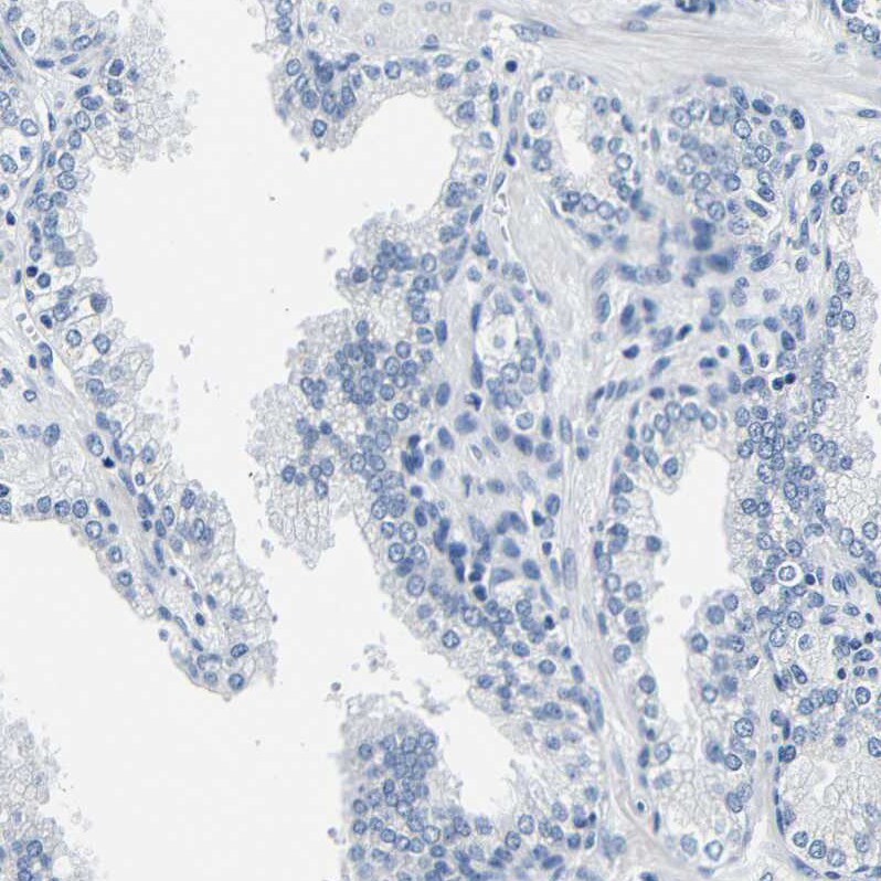 CD42b/GPIb alpha Antibody - BSA Free Immunohistochemistry-Paraffin: CD42b/GPIb alpha Antibody [NBP1-85749]