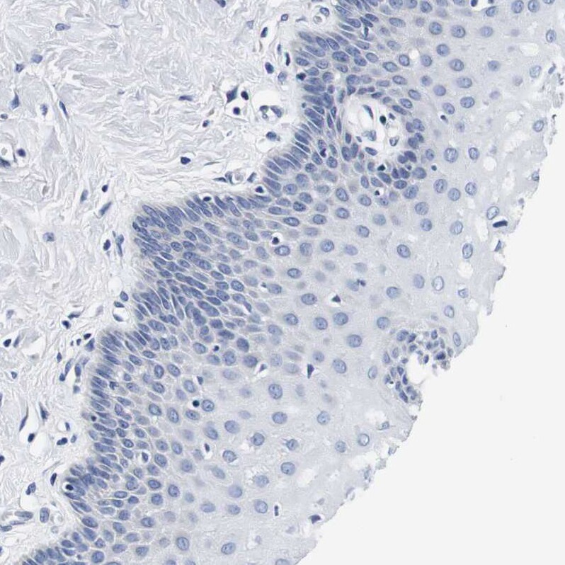 CD42b/GPIb alpha Antibody - BSA Free Immunohistochemistry-Paraffin: CD42b/GPIb alpha Antibody [NBP1-85749]