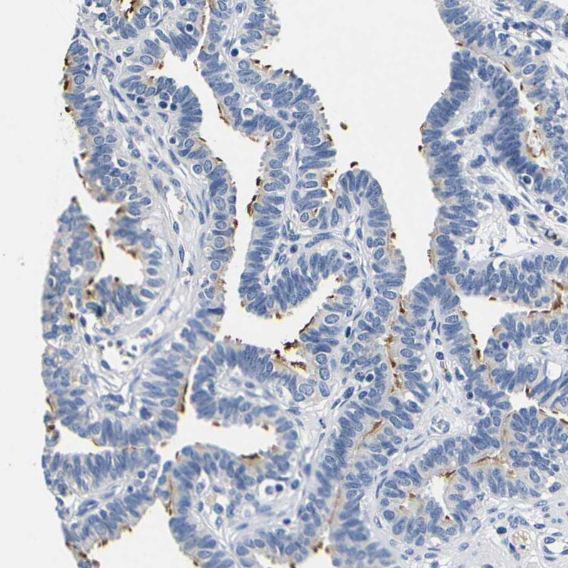 CD42b/GPIb alpha Antibody - BSA Free Immunohistochemistry-Paraffin: CD42b/GPIb alpha Antibody [NBP1-85749]