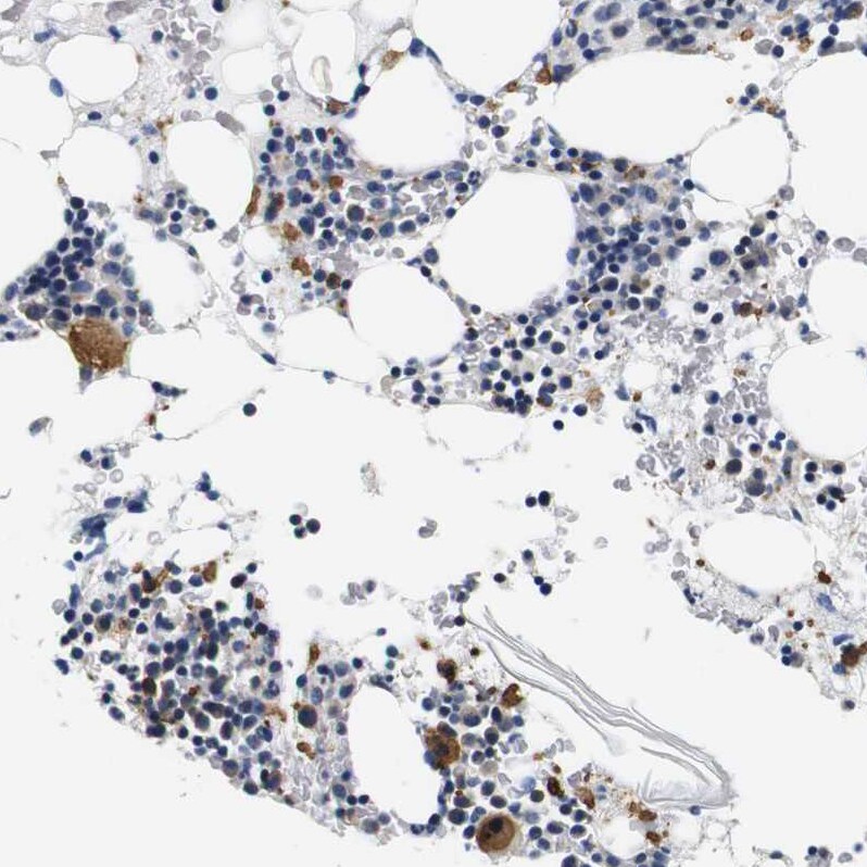 CD42b/GPIb alpha Antibody - BSA Free Immunohistochemistry-Paraffin: CD42b/GPIb alpha Antibody - BSA Free [NBP1-85749]