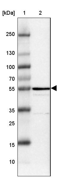 CD39L4/ENTPD5 Antibody - BSA Free Western Blot: CD39L4/ENTPD5 Antibody - BSA Free [NBP1-85751]