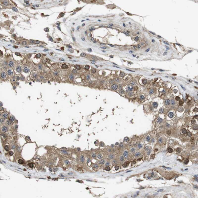 Frizzled-10 Antibody - BSA Free Immunohistochemistry-Paraffin: Frizzled-10 Antibody [NBP1-85753]
