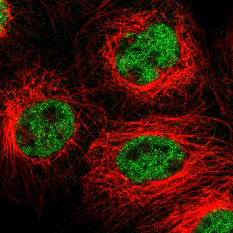 Frizzled-10 Antibody - BSA Free Immunocytochemistry/ Immunofluorescence: Frizzled-10 Antibody - BSA Free [NBP1-85753]