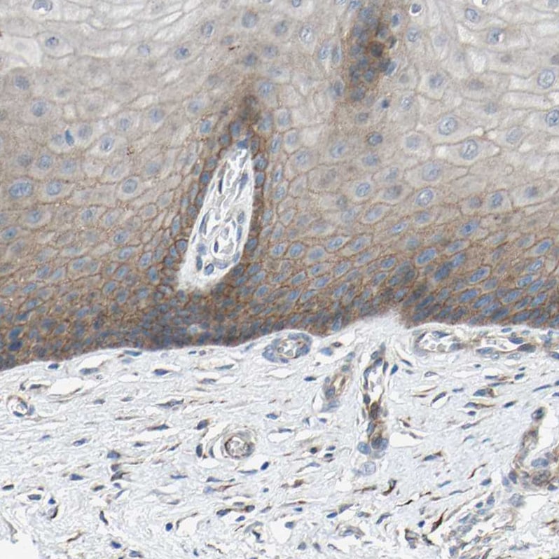 CDCP1 Antibody - BSA Free Immunohistochemistry-Paraffin: CDCP1 Antibody - BSA Free [NBP1-85758]