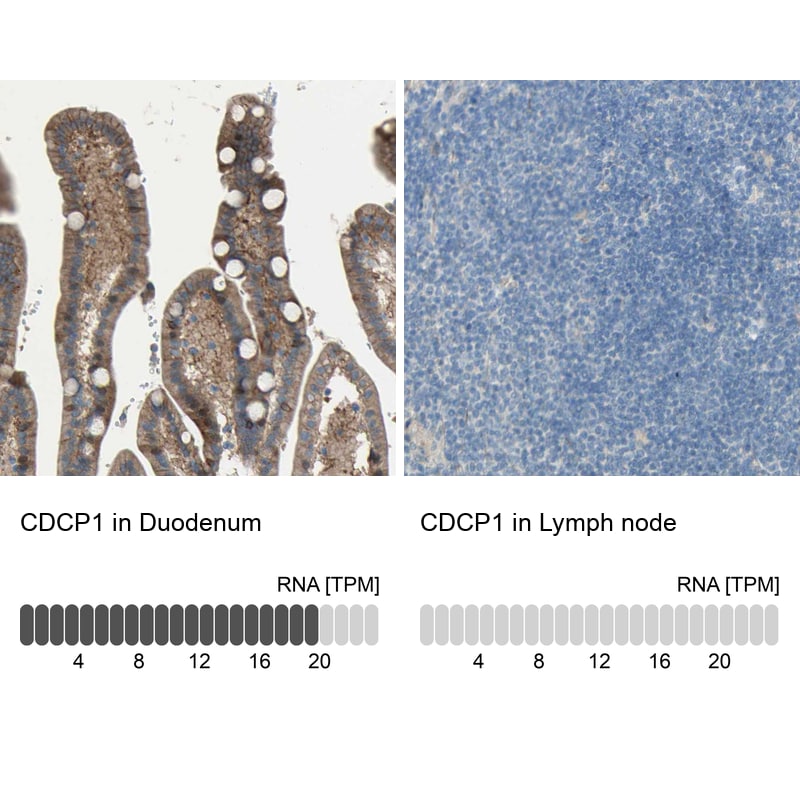 CDCP1 Antibody - BSA Free Immunohistochemistry-Paraffin: CDCP1 Antibody - BSA Free [NBP1-85758]