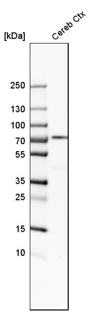 IGSF8/CD316 Antibody - BSA Free Western Blot: IGSF8/CD316 Antibody - BSA Free [NBP1-85761]