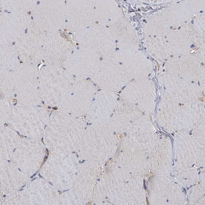Neuropilin-1 Antibody - BSA Free Immunohistochemistry-Paraffin: Neuropilin-1 Antibody - BSA Free [NBP1-85763]