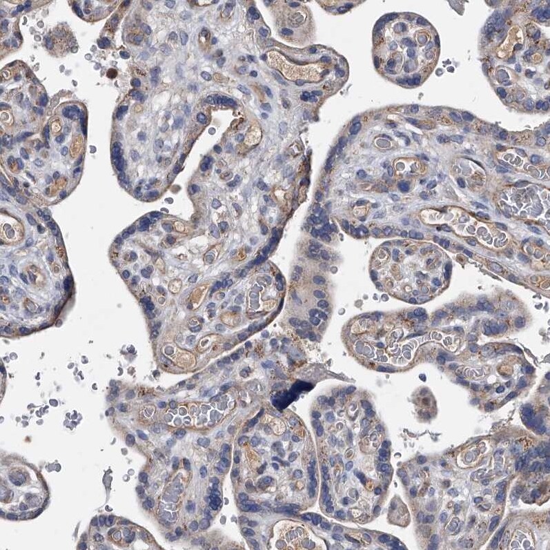 Neuropilin-1 Antibody - BSA Free Immunohistochemistry-Paraffin: Neuropilin-1 Antibody - BSA Free [NBP1-85763]