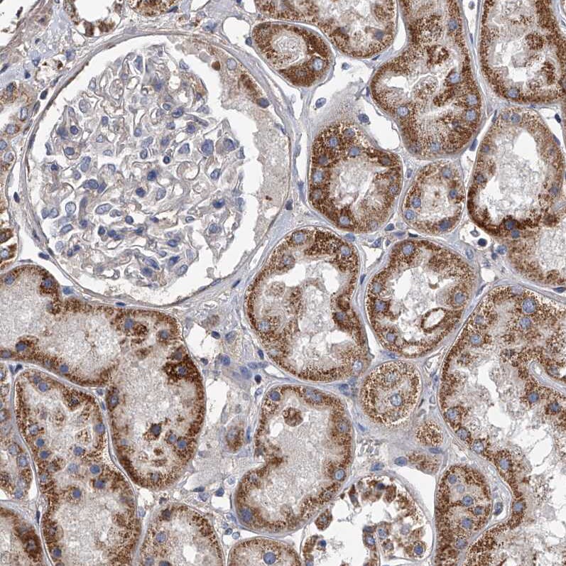 Neuropilin-1 Antibody - BSA Free Immunohistochemistry-Paraffin: Neuropilin-1 Antibody - BSA Free [NBP1-85763]