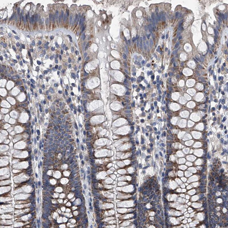 Neuropilin-1 Antibody - BSA Free Immunohistochemistry-Paraffin: Neuropilin-1 Antibody - BSA Free [NBP1-85763]