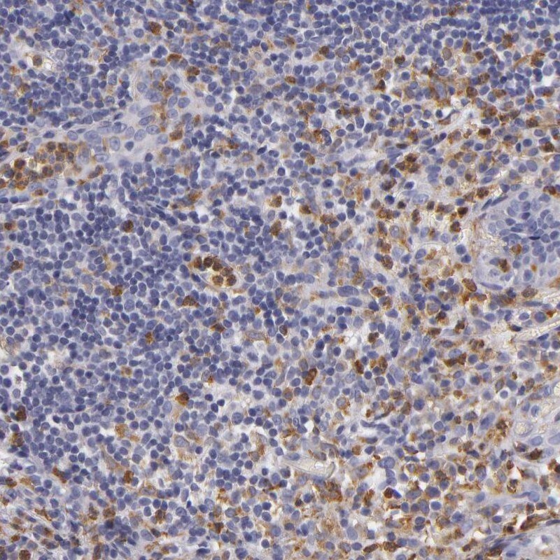 TLR8 Antibody - BSA Free Immunohistochemistry: TLR8 Antibody - BSA Free [NBP1-85767]