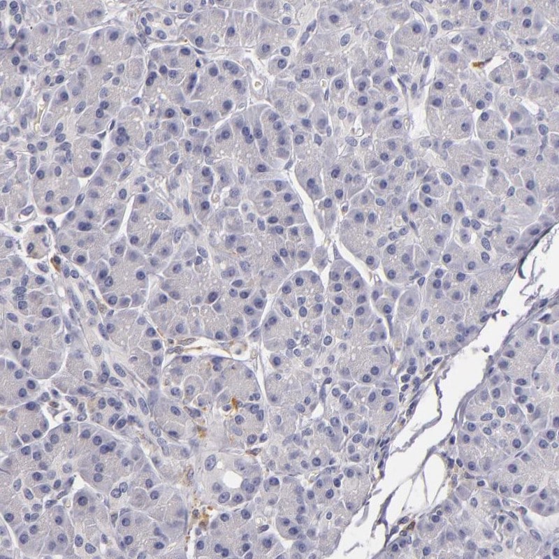 TLR8 Antibody - BSA Free Immunohistochemistry: TLR8 Antibody - BSA Free [NBP1-85767]