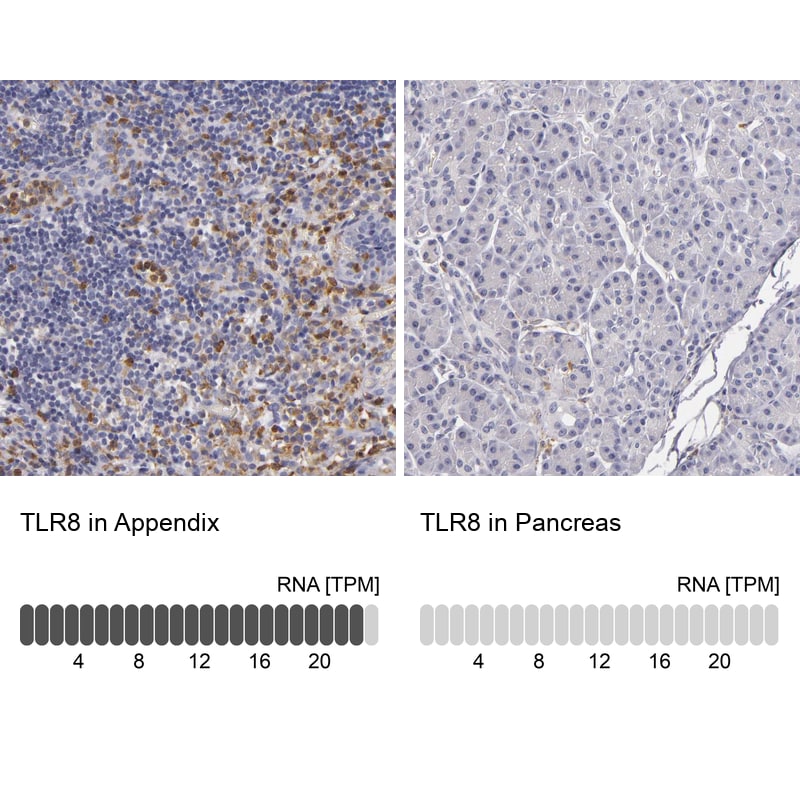 TLR8 Antibody - BSA Free Immunohistochemistry: TLR8 Antibody - BSA Free [NBP1-85767]